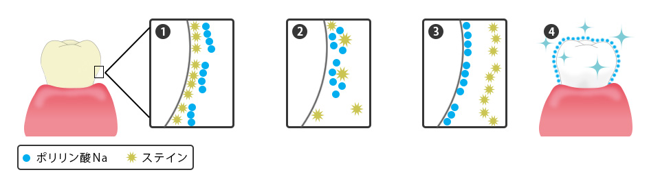 ステインの付着を防ぎ、歯を健康的に美しく